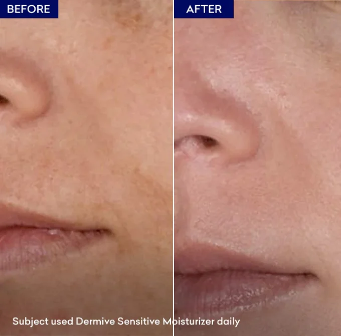 DERMIVE SENSITIVE MOISTURIZER